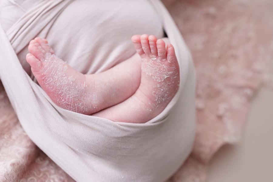 Protetto: RUi – Servizio Newborn Napoli